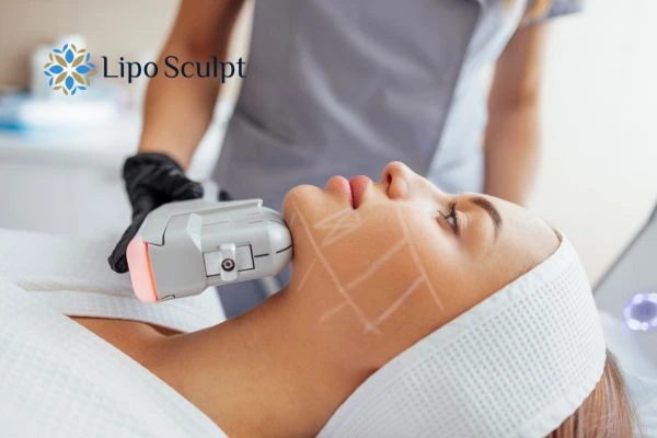 HIFU vs Botulinum Toxin: Understanding the Differences 1 HIFU vs Botox Rochdale What is the best option for you?