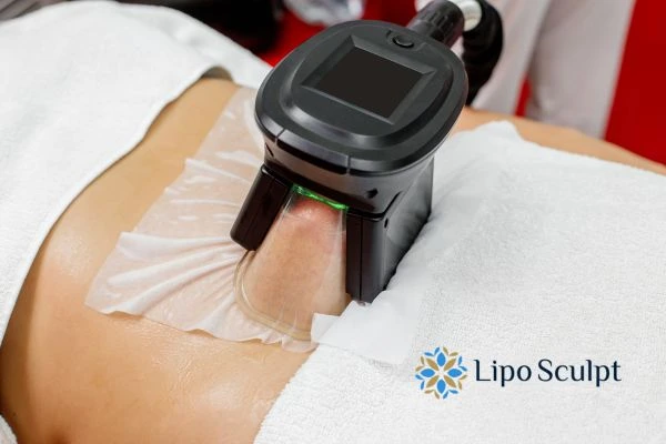 Does Fat Freezing at Home Work? DIY Devices vs Professional Cryolipolysis 1 How is professional cryolipolysis different Rochdale?
