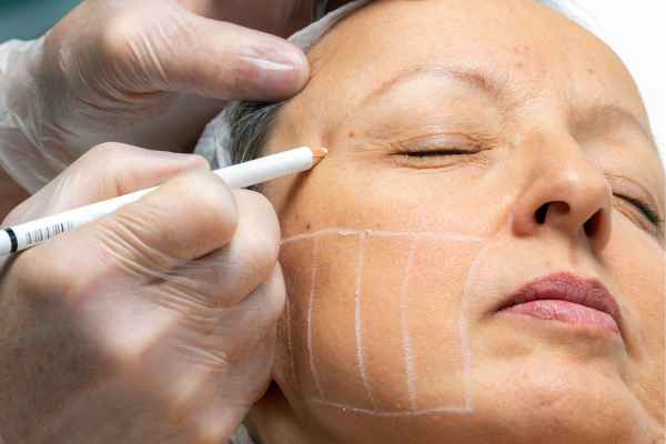 CryoPen: 5 Skin Concerns It May Be Used to Treat 4 What should you ask before having CryoPen treatment Rochdale?