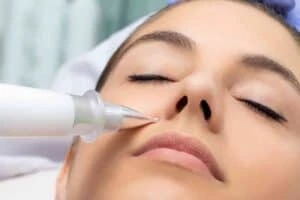 Best Actinic Keratoses Removal 3 Actinic keratoses Rochdale solutions - book in today!
