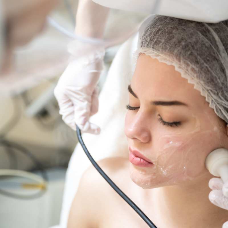 Why Do People Choose HIFU for a Non-Surgical Facelift? 5 What are the risks Rochdale?